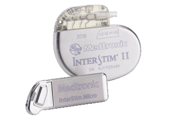 InterStim® – Treatment for Faecal Incontinence